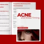 Acne and Stress Timing – A Practical Guide to Understanding acne and stress timing, Stress Triggers, and Breakout Patterns