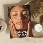 Melasma vs Sun Spots – The Complete Skincare eBook Guide to Understanding, Treating & Preventing Dark Spots Naturally